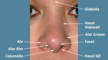 Glossary Of Terms Commonly Used In Primary Revision Rhinoplasty
